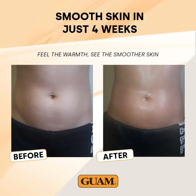 Gallery image: before and after four weeks of use